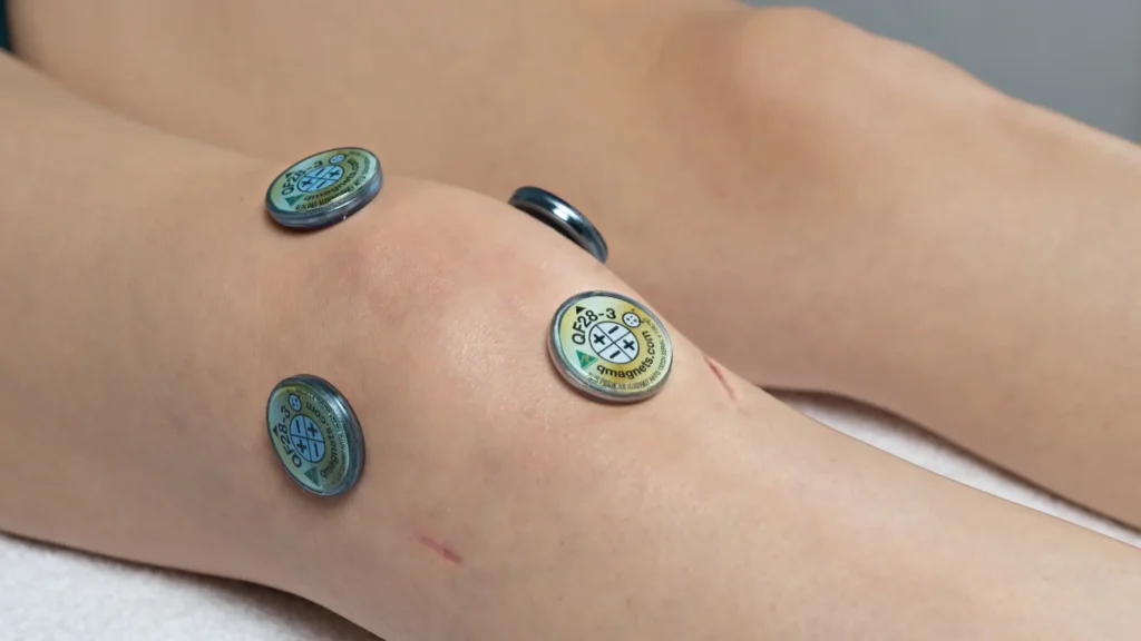 Magnet Therapy For Knee Pain