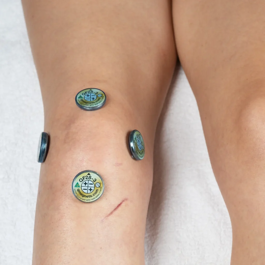 Magnets for Knee Pain